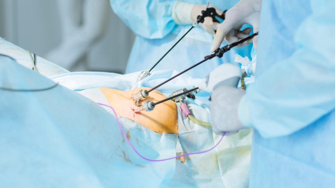 General & Laparoscopic Surgery
